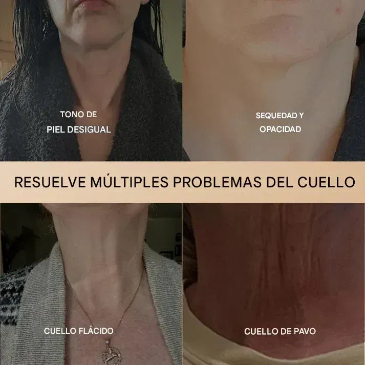 InfinitePeptides - Kit Reafirmante