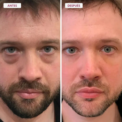 Bálsamo Facial Reafirmante - Elimina Arrugas y Líneas de Expresión