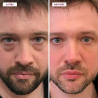 Bálsamo Facial Reafirmante - Elimina Arrugas y Líneas de Expresión