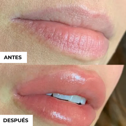 Voluminizador de Labios GLUMI