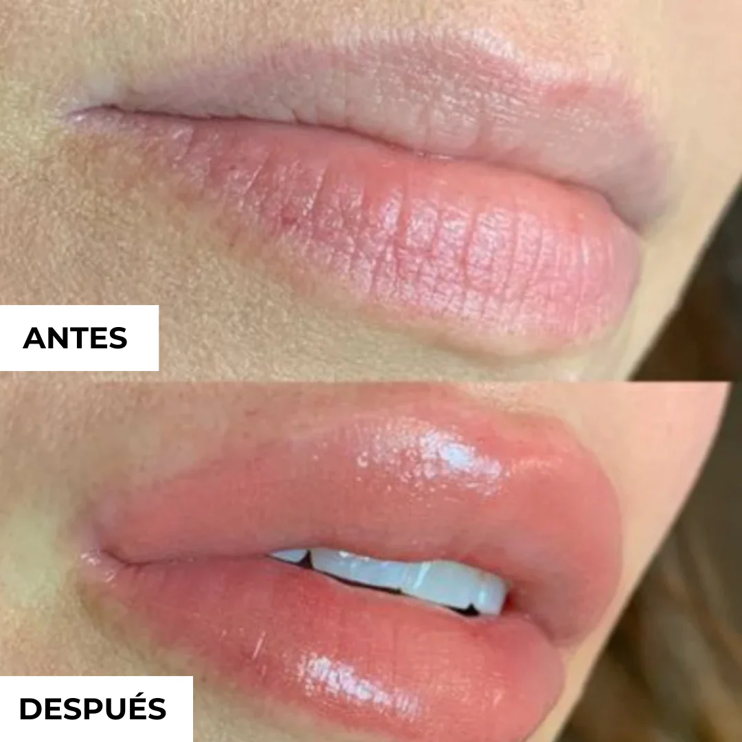Voluminizador de Labios GLUMI