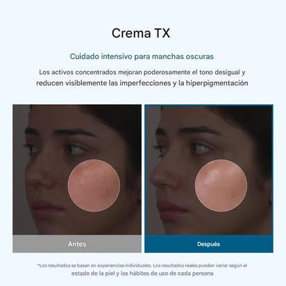 Crema Facial Despigmentante – Reduce Manchas y Unifica el Tono