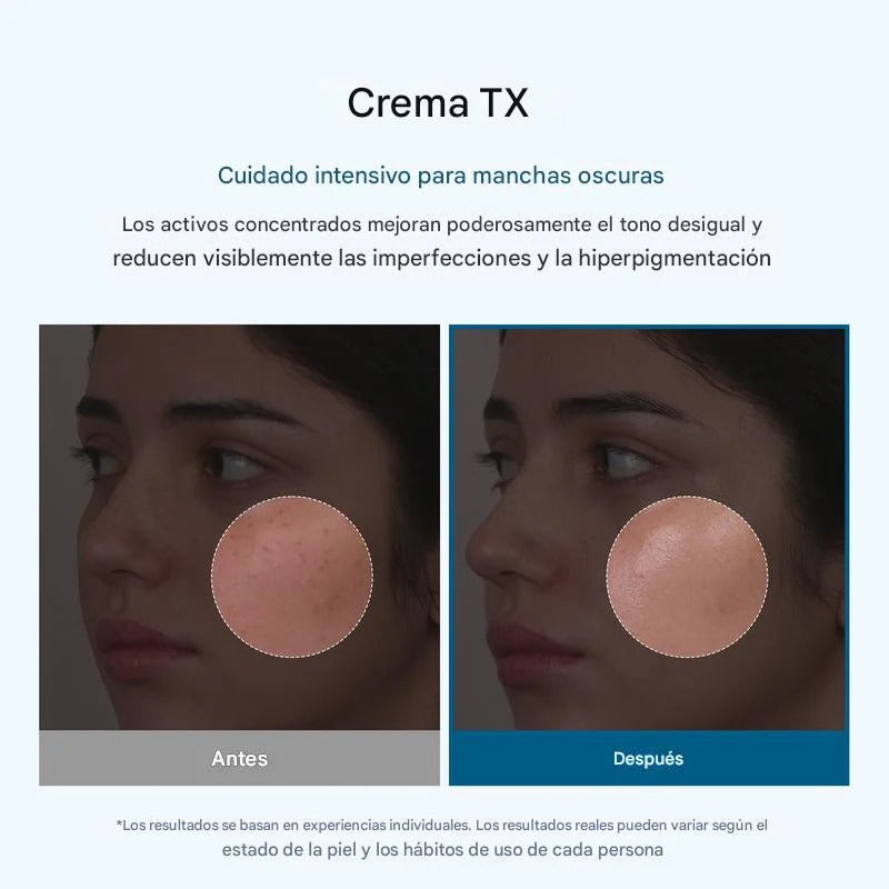 Crema Facial Despigmentante – Reduce Manchas y Unifica el Tono