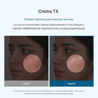 Crema Facial Despigmentante – Reduce Manchas y Unifica el Tono