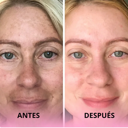 Algodones de Cúrcuma y Ácido Kójico