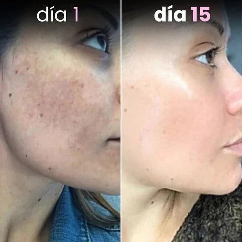 Algodones de Cúrcuma y Ácido Kójico