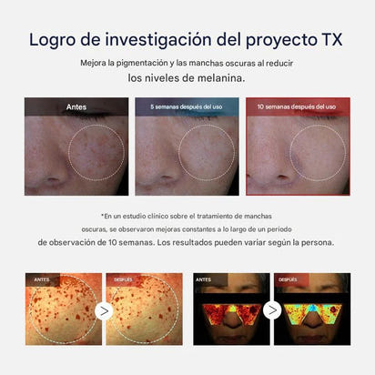 Crema Facial Despigmentante – Reduce Manchas y Unifica el Tono